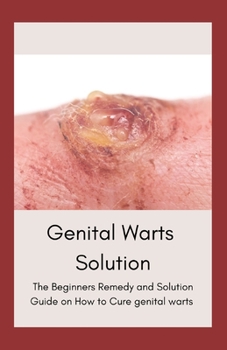 Paperback Genital Warts Solution: The Beginners Remedy and Solution Guide on How to Cure genital warts Book