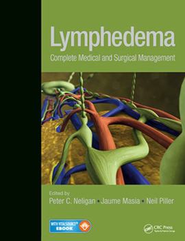 Hardcover Lymphedema: Complete Medical and Surgical Management Book