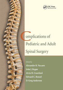Paperback Complications of Pediatric and Adult Spinal Surgery Book
