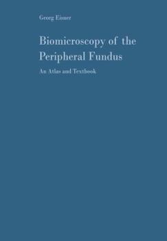 Paperback Biomicroscopy of the Peripheral Fundus: An Atlas and Textbook Book