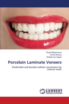 Paperback Porcelain Laminate Veneers Book