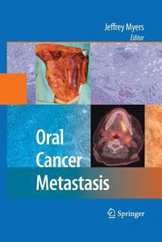 Paperback Oral Cancer Metastasis Book