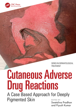 Cutaneous Adverse Drug Reactions: A Case Based Approach for Deeply Pigmented Skin (Series in Dermatological Treatment)