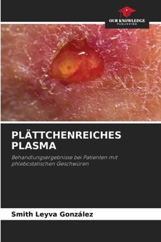 Paperback Plättchenreiches Plasma [German] Book