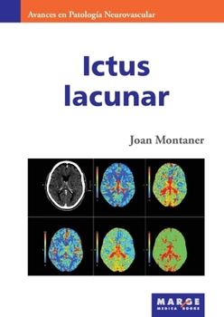 Paperback Ictus lacunar [Spanish] Book