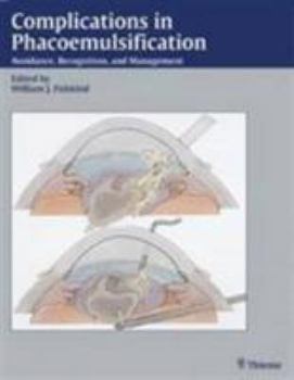 Hardcover Complications in Phacoemulsification. Avoidance, Recognition, and Management. Book