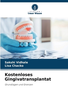 Kostenloses Gingivatransplantat (German Edition)