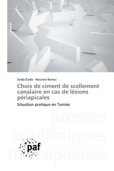Paperback Choix de ciment de scellement canalaire en cas de lésions périapicales [French] Book
