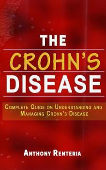 Paperback The Crohn's Disease: Complete Guide on Understanding and Managing Crohn's Disease Book