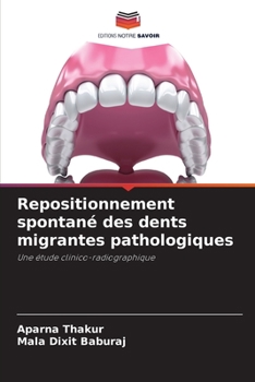 Paperback Repositionnement spontané des dents migrantes pathologiques [French] Book