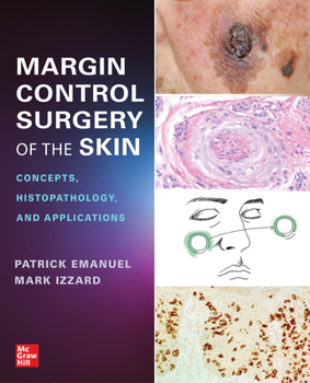 Paperback Margin Control Surgery of the Skin: Concepts, Histopathology, and Applications Book