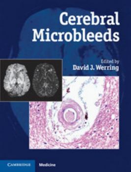 Hardcover Cerebral Microbleeds: Pathophysiology to Clinical Practice Book