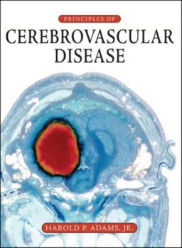 Hardcover Principles of Cerebrovascular Disease Book