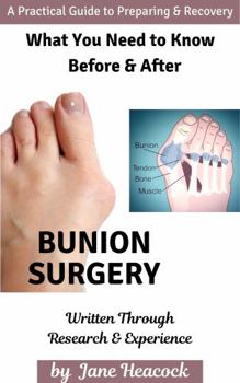 Paperback Bunion Surgery: A Practical Guide to Preparing & Recovery Book