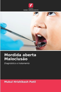 Mordida aberta Maloclusão: Diagnóstico e tratamento (Portuguese Edition)