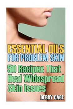 Paperback Essential Oils For Problem Skin: 50 Recipes That Heal Widespread Skin Issues Book