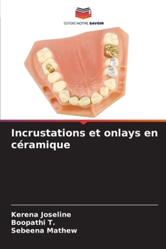 Paperback Incrustations et onlays en céramique [French] Book