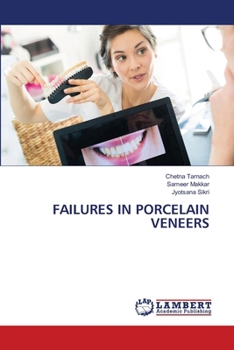 Paperback Failures in Porcelain Veneers Book