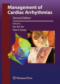 Hardcover Management of Cardiac Arrhythmias Book