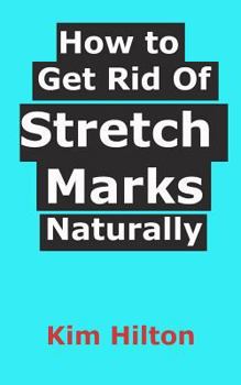Paperback How to Get Rid Of Stretch Marks Naturally Book