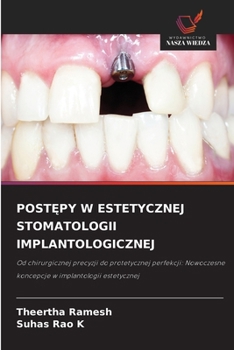 PostEpy W Estetycznej Stomatologii Implantologicznej (Polish Edition)