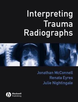 Paperback Interpreting Trauma Radiographs Book