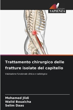 Paperback Trattamento chirurgico delle fratture isolate del capitello [Italian] Book