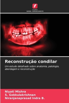 Paperback Reconstrução condilar [Portuguese] Book