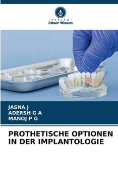 Prothetische Optionen in Der Implantologie (German Edition)