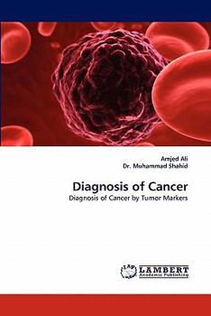 Paperback Diagnosis of Cancer Book