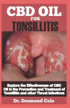 TONSILLITIS: Explore the Effectiveness of CBD Oil in the Prevention and Treatment of Tonsillitis and other Throat Infections