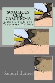 Paperback Squamous Cell Carcinoma: Causes, Tests and Treatment Options Book