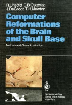 Paperback Computer Reformations of the Brain and Skull Base: Anatomy and Clinical Application Book