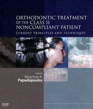 Hardcover Orthodontic Treatment of the Class II Noncompliant Patient: Current Principles and Techniques Book