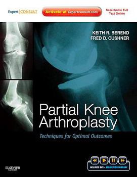 Hardcover Partial Knee Arthroplasty: Techniques for Optimal Outcomes with DVD; Expert Consult - Online & Print Book