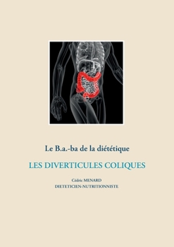 Le B.a.-Ba. diététique pour les diverticules coliques (Savoir quoi manger, tout simplement... (-)) (French Edition)