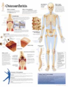 Paperback Understanding Osteoarthritis Chart: Wall Chart Book
