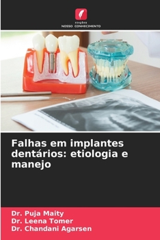 Paperback Falhas em implantes dentários: etiologia e manejo [Portuguese] Book