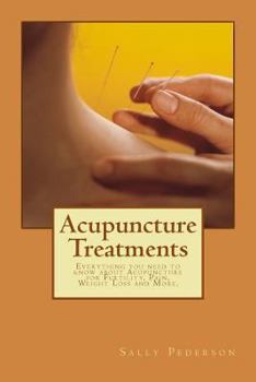 Paperback Acupuncture Treatments: Everything You Need to Know about Acupuncture for Fertility, Pain, Weight Loss and More. Book