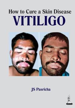 Paperback How to Cure a Skin Disease: Vitiligo Book
