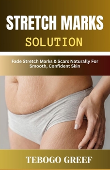 Paperback Stretch Marks Solution: Fade Stretch Marks & Scars Naturally For Smooth, Confident Skin Book
