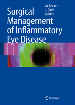 Hardcover Surgical Management of Inflammatory Eye Disease Book