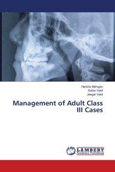 Paperback Management of Adult Class III Cases Book