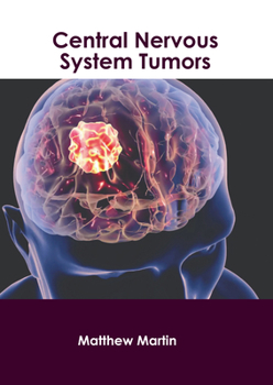 Hardcover Central Nervous System Tumors Book