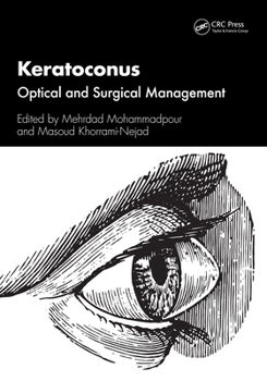 Paperback Keratoconus: Optical and Surgical Management Book