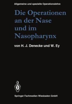 Paperback Die Operationen an Der Nase Und Im Nasopharynx: Mit Berücksichtigung Der Transsphenoidalen Operationen an Der Hypophyse Und Der Eingriffe Am Vegetativ [German] Book