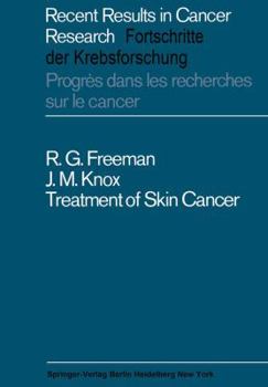 Paperback Treatment of Skin Cancer Book