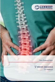 Paperback У меня сколиоз [Russian] Book