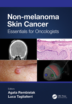 Hardcover Non-Melanoma Skin Cancer: Essentials for Oncologists Book