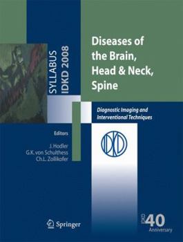 Paperback Diseases of the Brain, Head & Neck, Spine: Diagnostic Imaging and Interventional Techniques Book